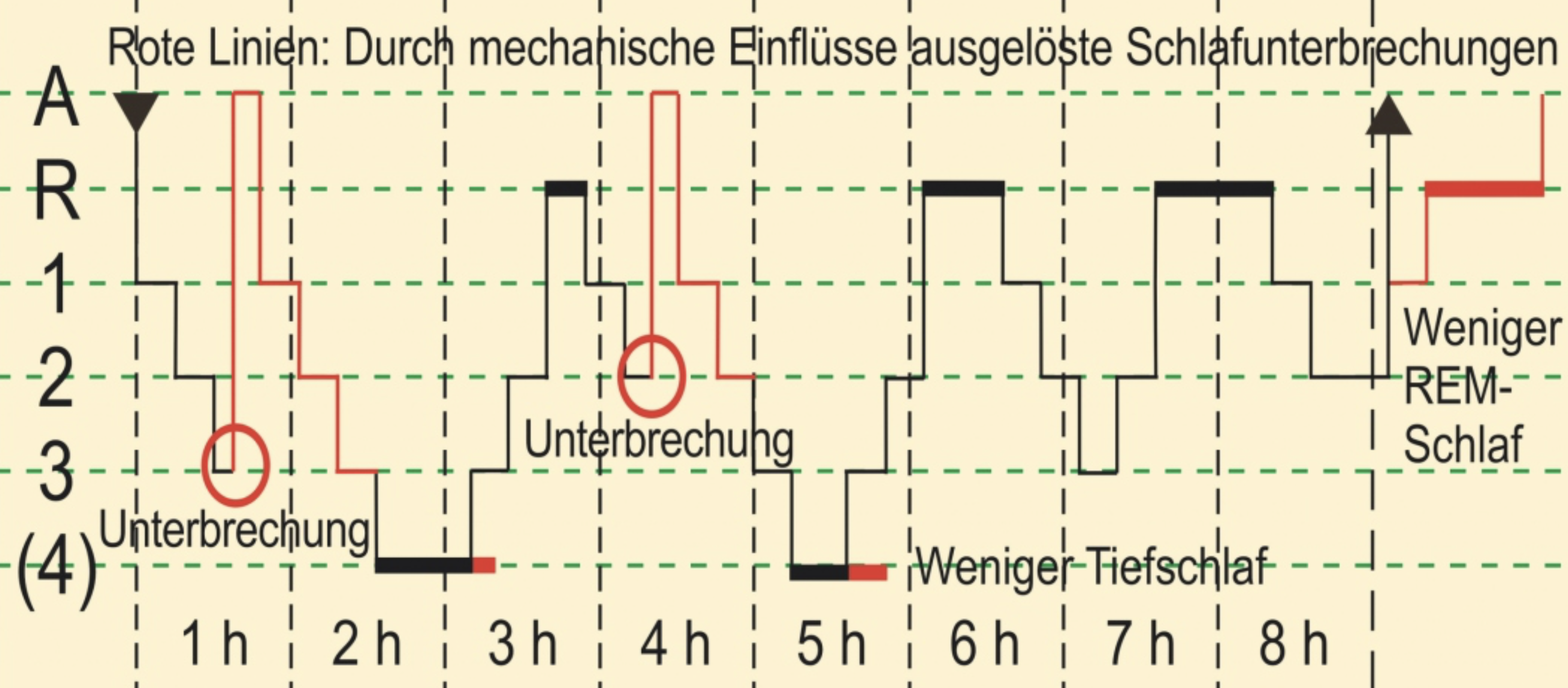 Gestörter Schlaf